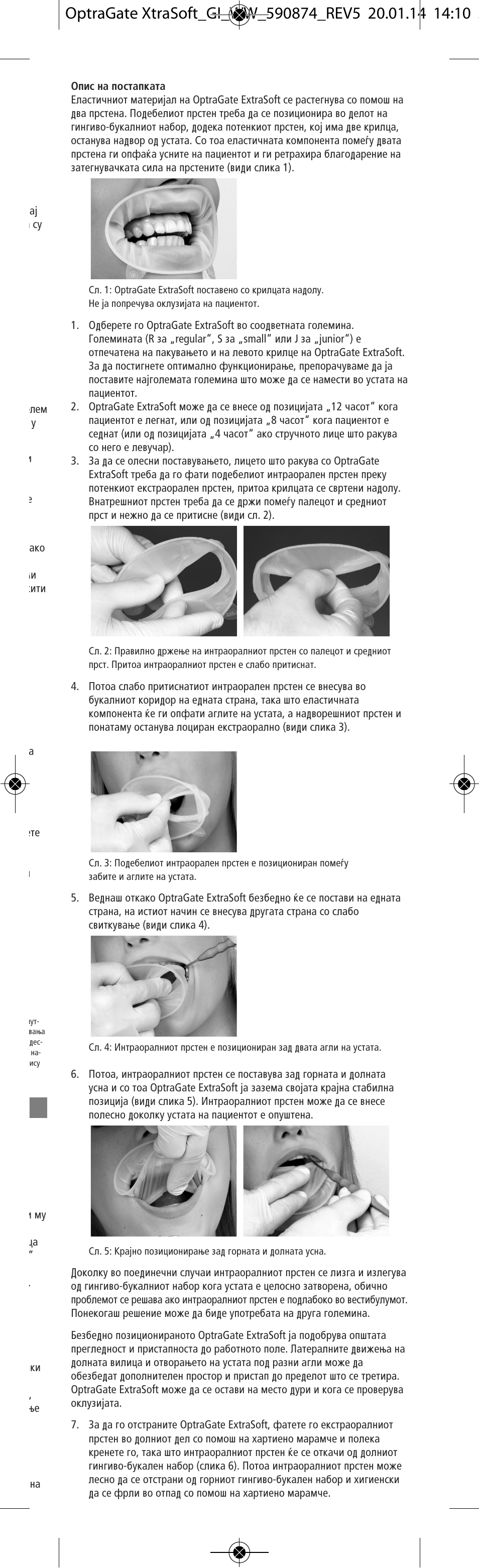 Ivoclar Vivadent OptraGate ExtraSoft Version v.5 User Manual | Page 33 / 48