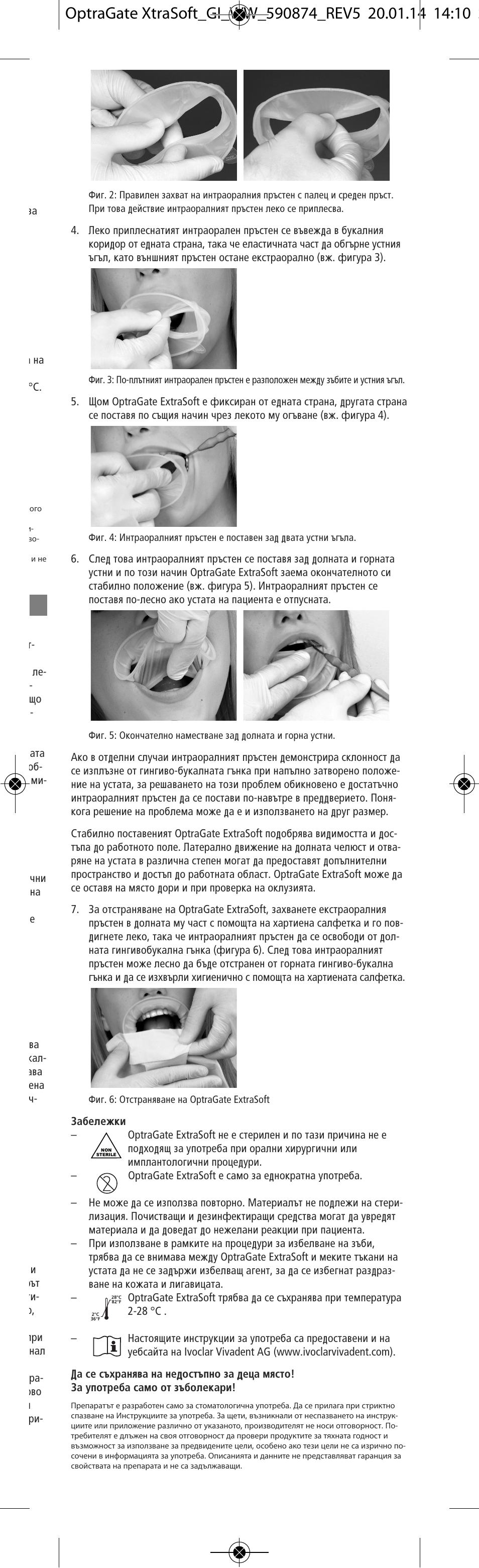 Ivoclar Vivadent OptraGate ExtraSoft Version v.5 User Manual | Page 35 / 48