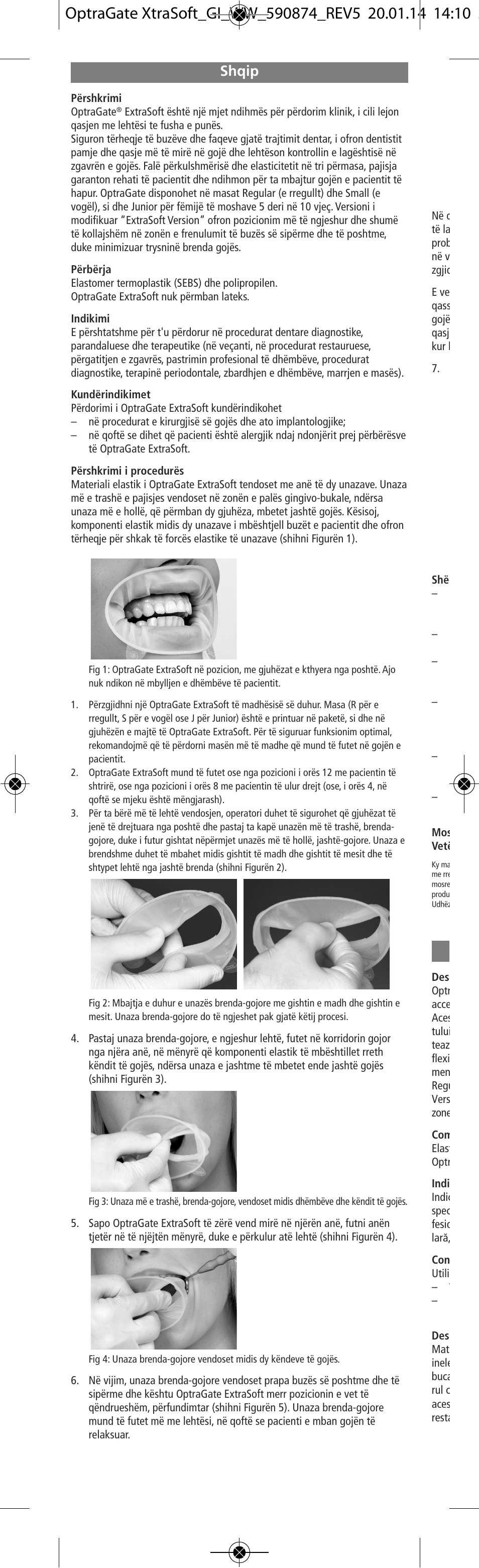 Shqip | Ivoclar Vivadent OptraGate ExtraSoft Version v.5 User Manual | Page 36 / 48
