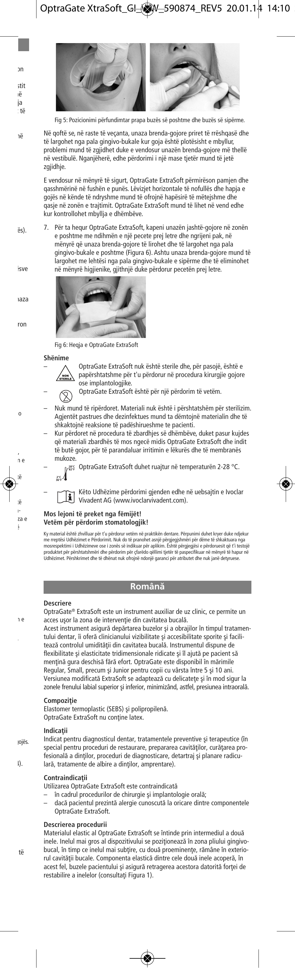 Româna, Românæ | Ivoclar Vivadent OptraGate ExtraSoft Version v.5 User Manual | Page 37 / 48