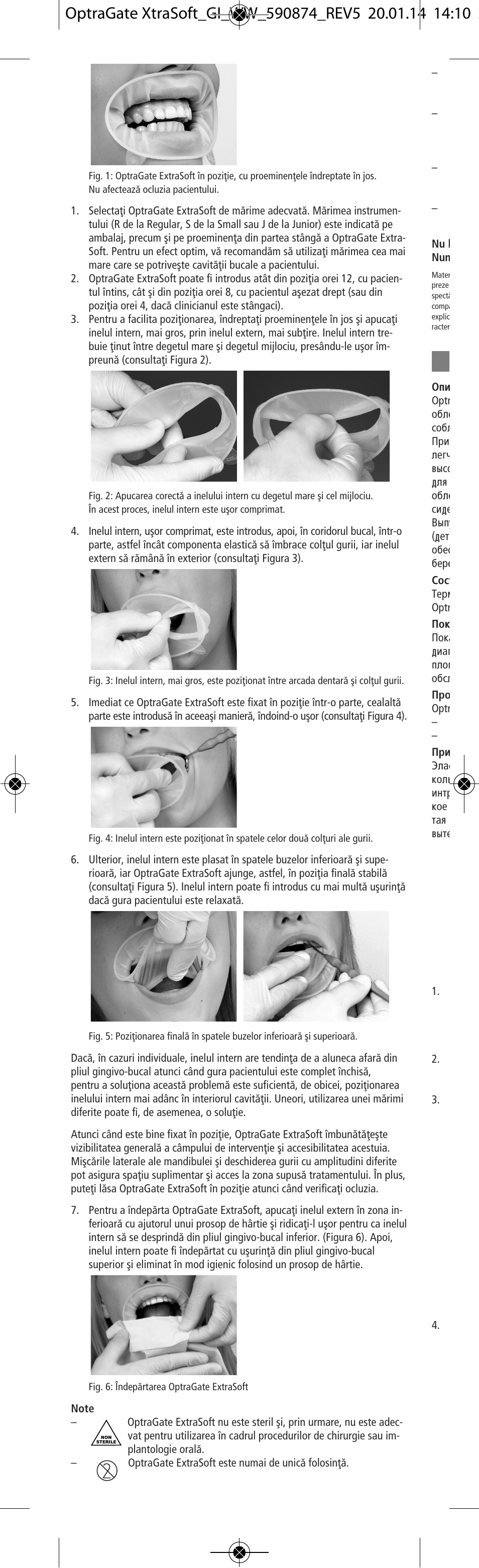 Ivoclar Vivadent OptraGate ExtraSoft Version v.5 User Manual | Page 38 / 48