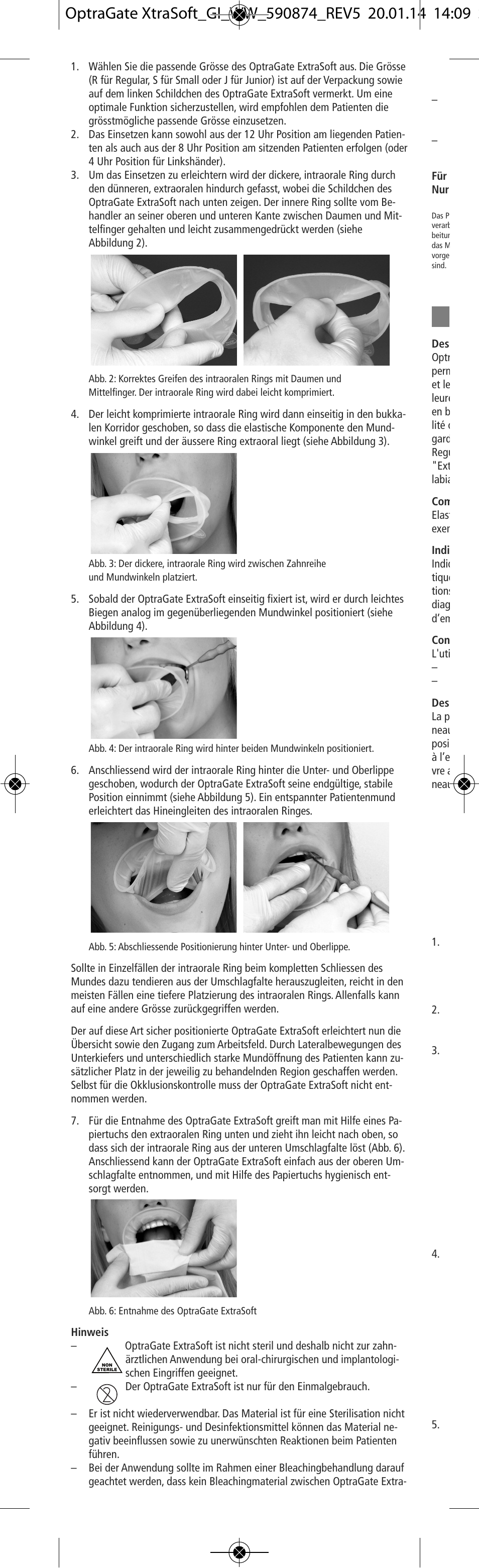 Ivoclar Vivadent OptraGate ExtraSoft Version v.5 User Manual | Page 4 / 48