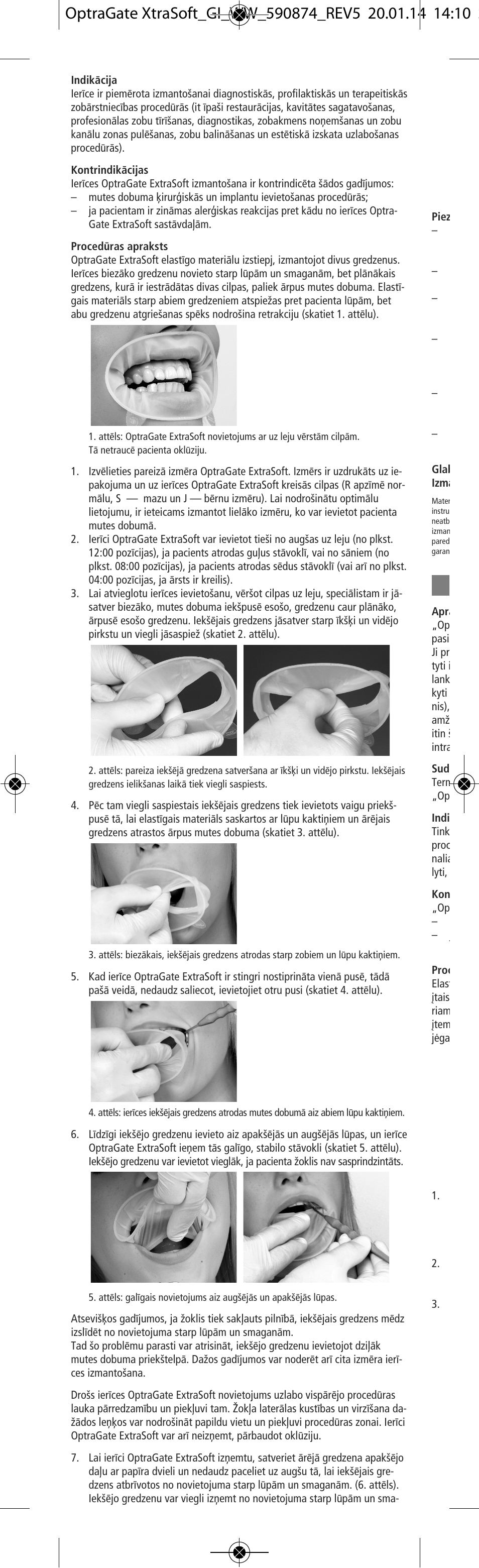 Ivoclar Vivadent OptraGate ExtraSoft Version v.5 User Manual | Page 44 / 48