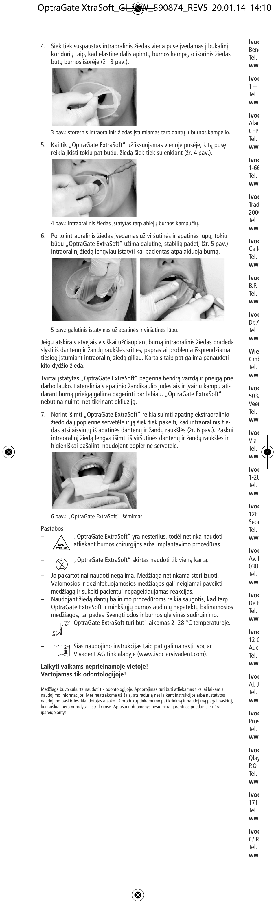 Ivoclar Vivadent OptraGate ExtraSoft Version v.5 User Manual | Page 46 / 48