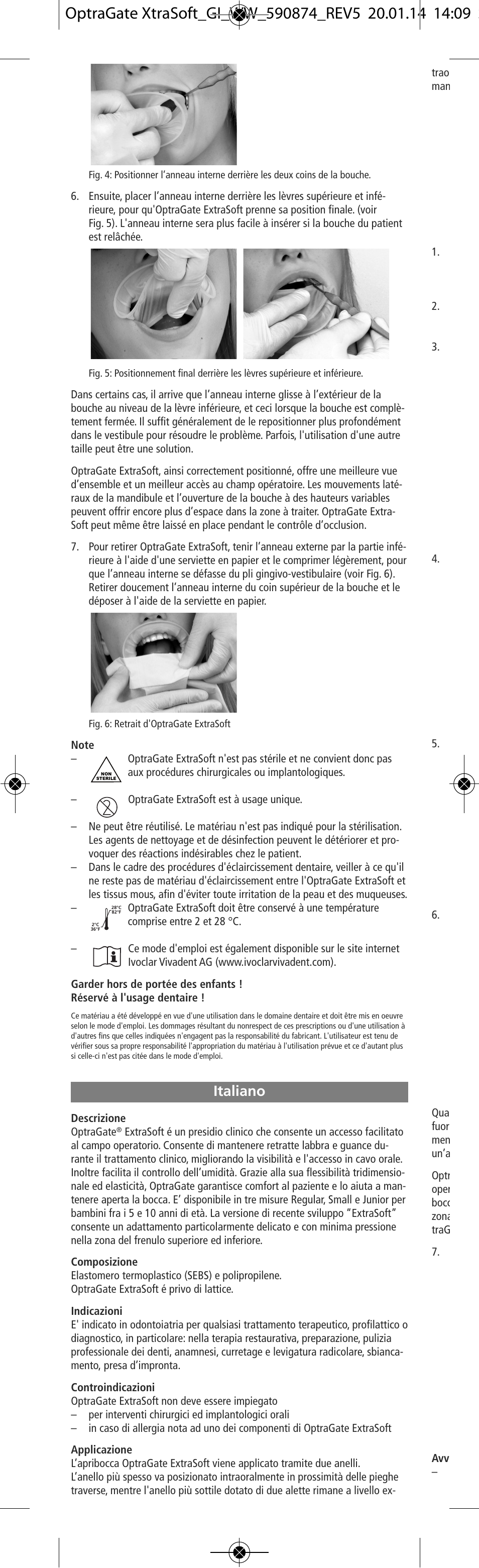 Italiano | Ivoclar Vivadent OptraGate ExtraSoft Version v.5 User Manual | Page 6 / 48