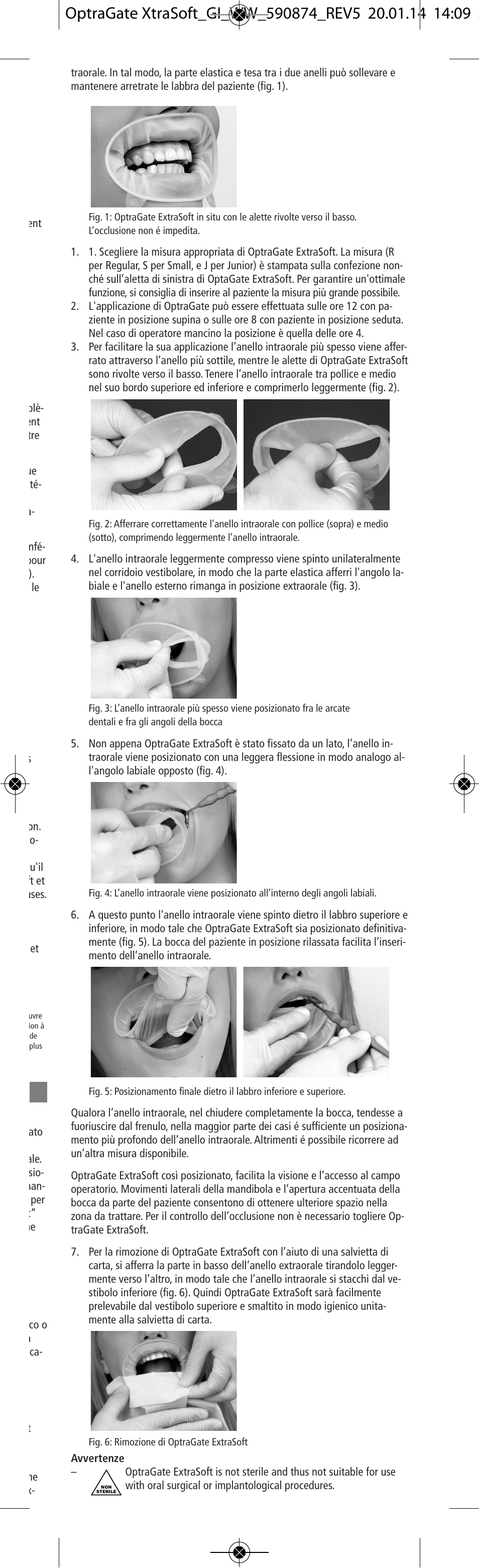 Ivoclar Vivadent OptraGate ExtraSoft Version v.5 User Manual | Page 7 / 48