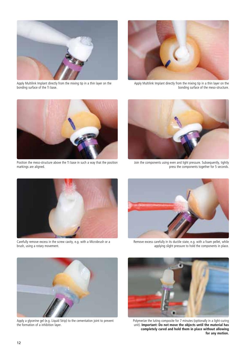 Ivoclar Vivadent IPS e.max Abutment Solutions Cem Kit v.3 User Manual | Page 12 / 80