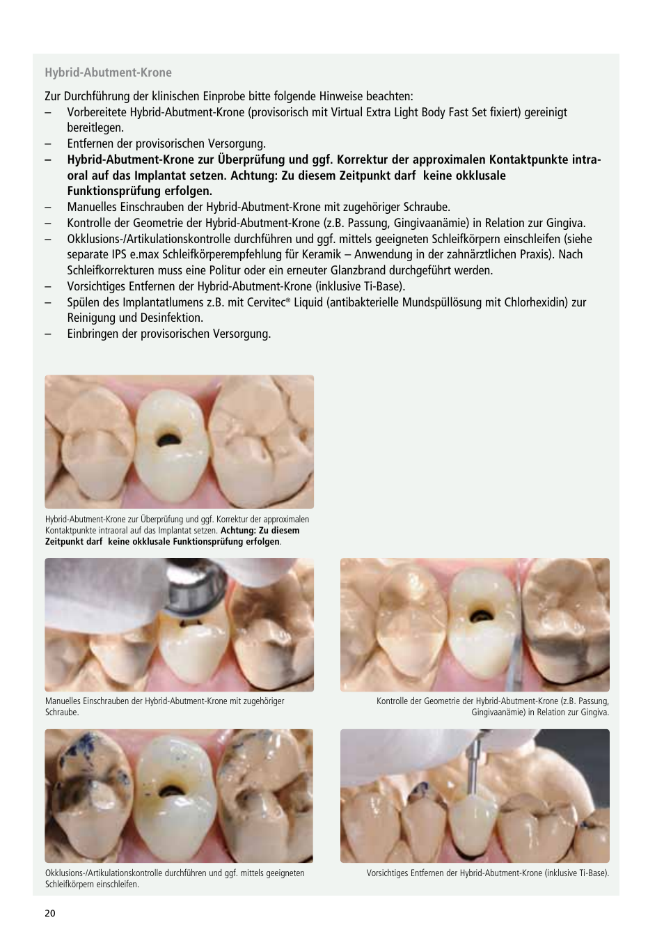 Ivoclar Vivadent IPS e.max Abutment Solutions Cem Kit v.3 User Manual | Page 20 / 80