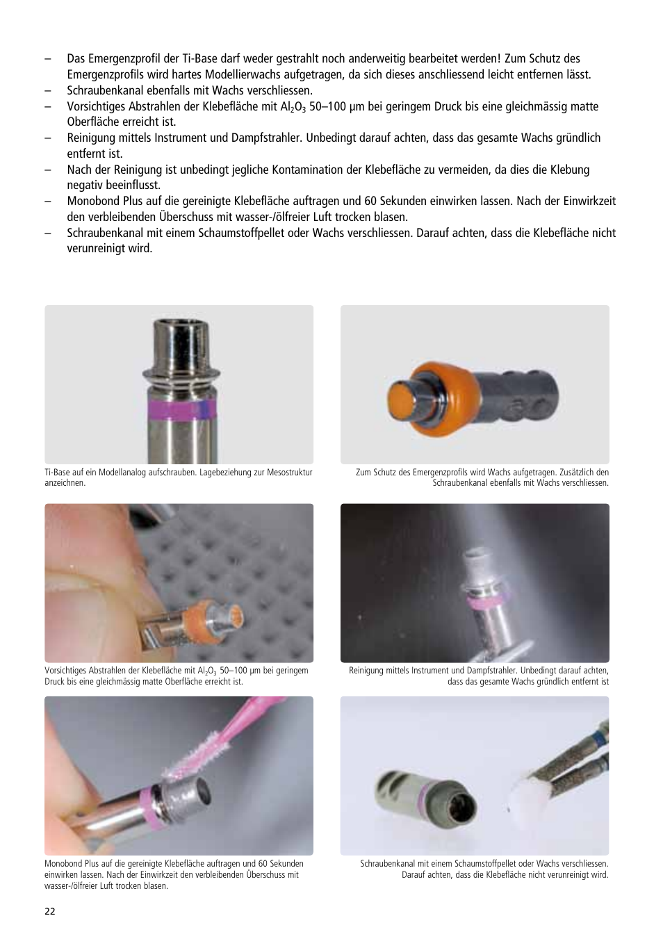 Ivoclar Vivadent IPS e.max Abutment Solutions Cem Kit v.3 User Manual | Page 22 / 80