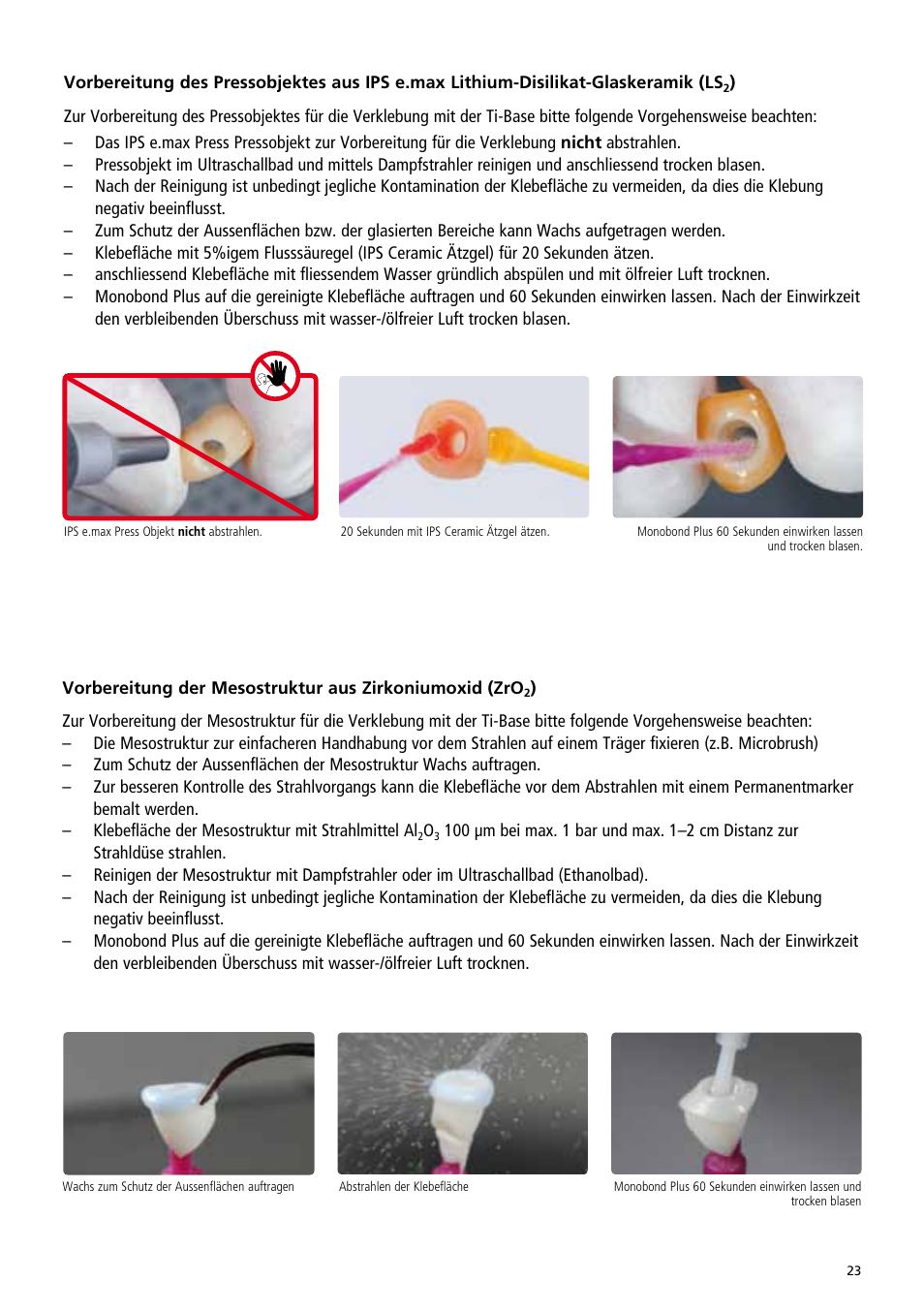 Ivoclar Vivadent IPS e.max Abutment Solutions Cem Kit v.3 User Manual | Page 23 / 80