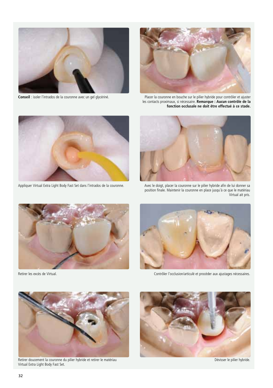 Ivoclar Vivadent IPS e.max Abutment Solutions Cem Kit v.3 User Manual | Page 32 / 80
