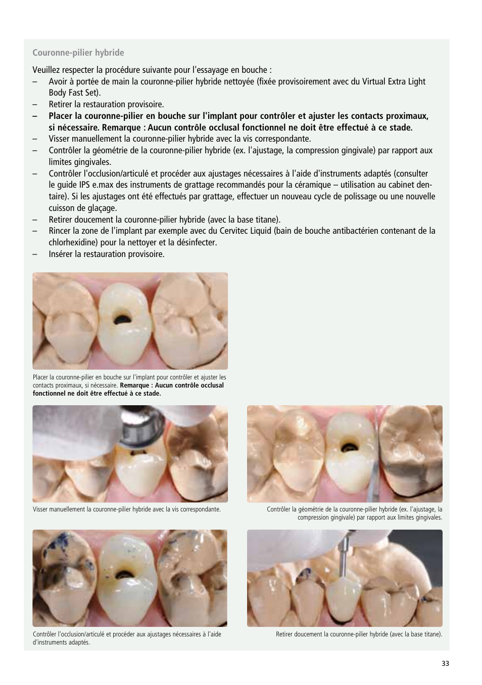 Ivoclar Vivadent IPS e.max Abutment Solutions Cem Kit v.3 User Manual | Page 33 / 80