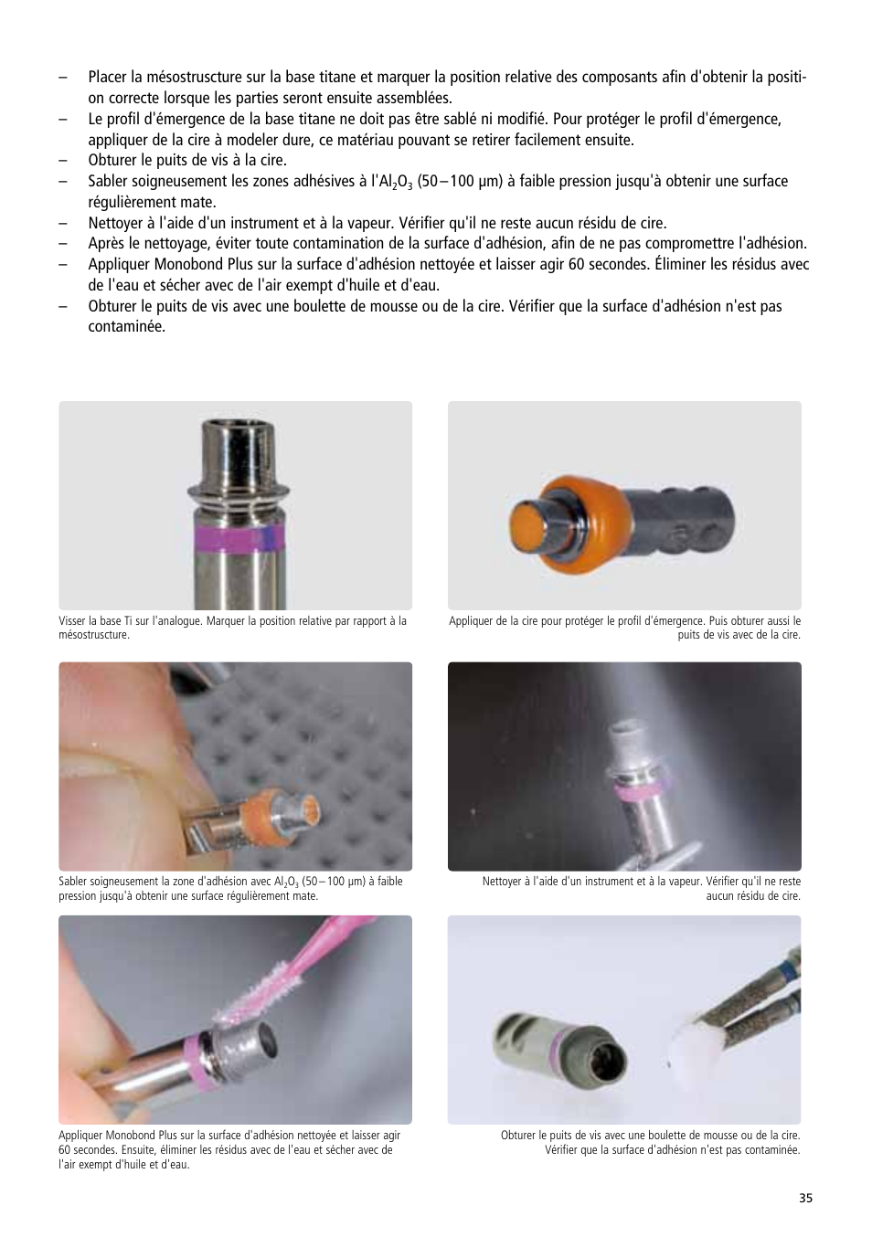 Ivoclar Vivadent IPS e.max Abutment Solutions Cem Kit v.3 User Manual | Page 35 / 80