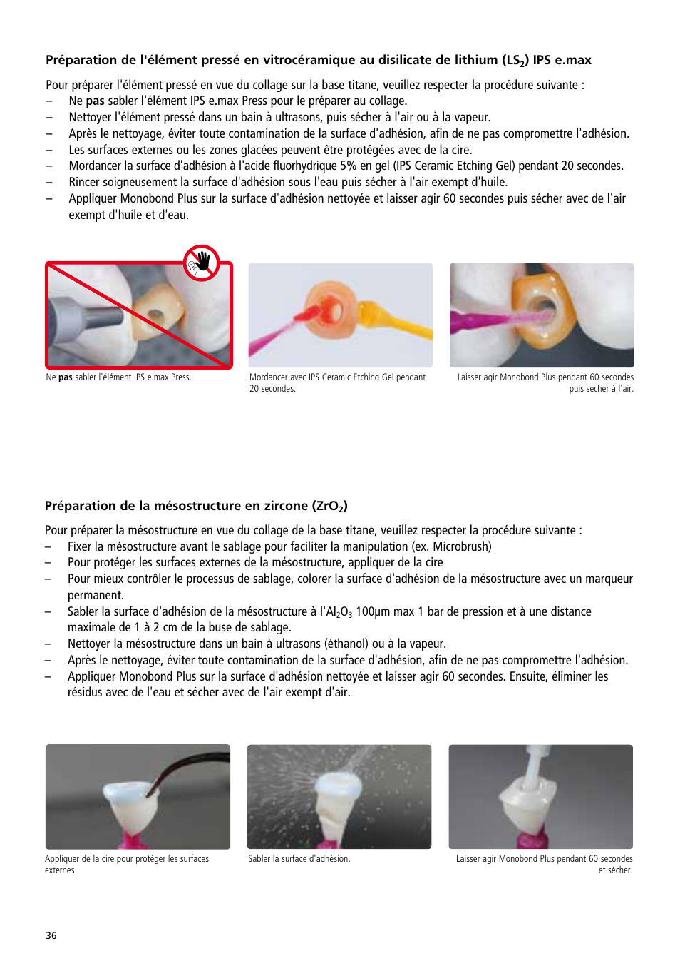 Ivoclar Vivadent IPS e.max Abutment Solutions Cem Kit v.3 User Manual | Page 36 / 80