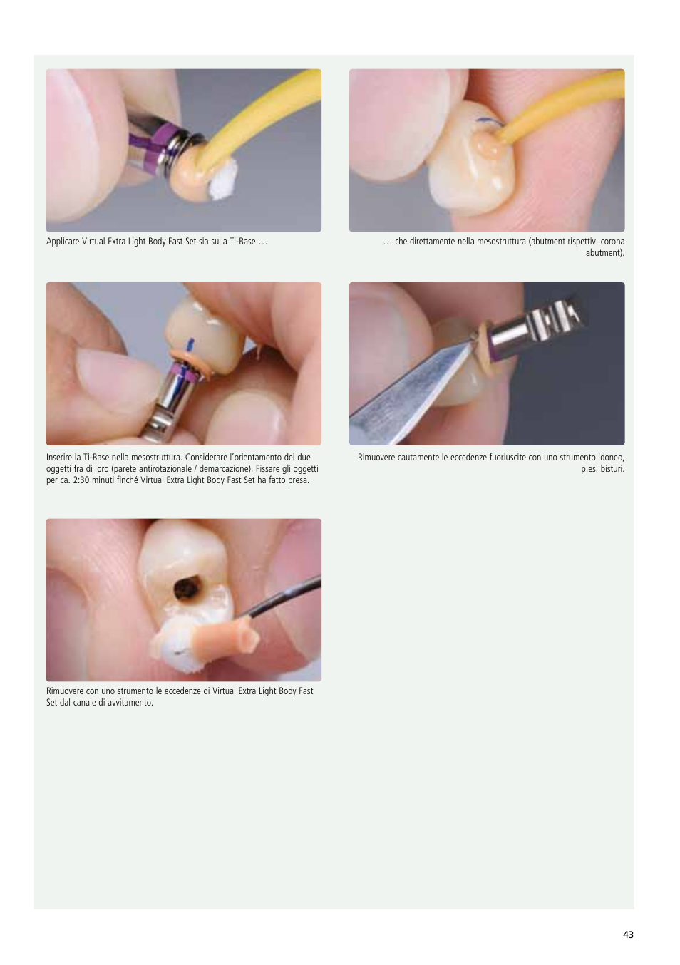 Ivoclar Vivadent IPS e.max Abutment Solutions Cem Kit v.3 User Manual | Page 43 / 80
