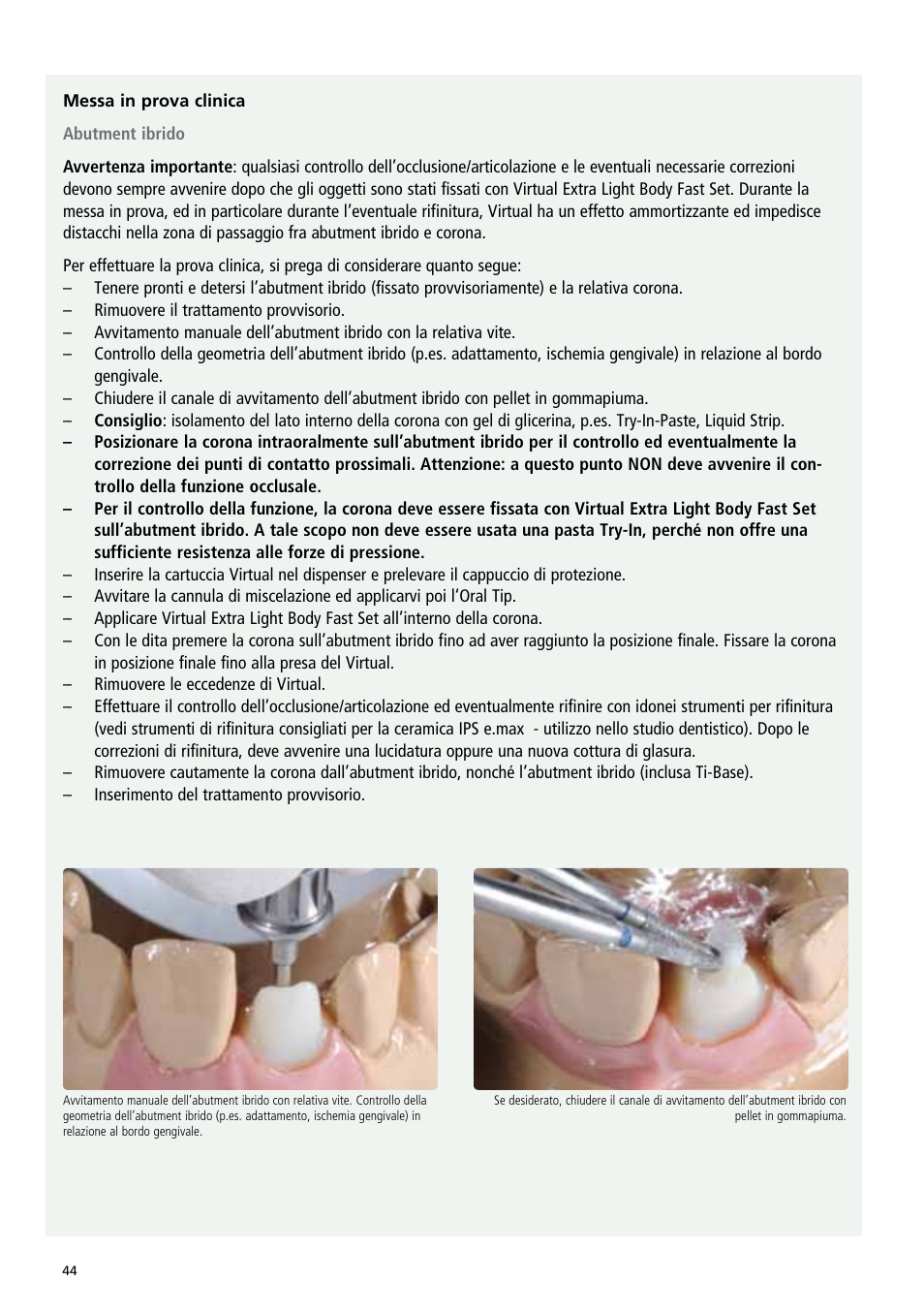 Ivoclar Vivadent IPS e.max Abutment Solutions Cem Kit v.3 User Manual | Page 44 / 80