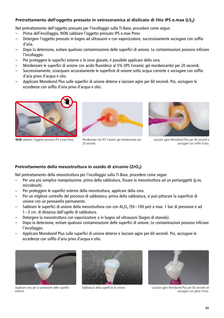Ivoclar Vivadent IPS e.max Abutment Solutions Cem Kit v.3 User Manual | Page 49 / 80
