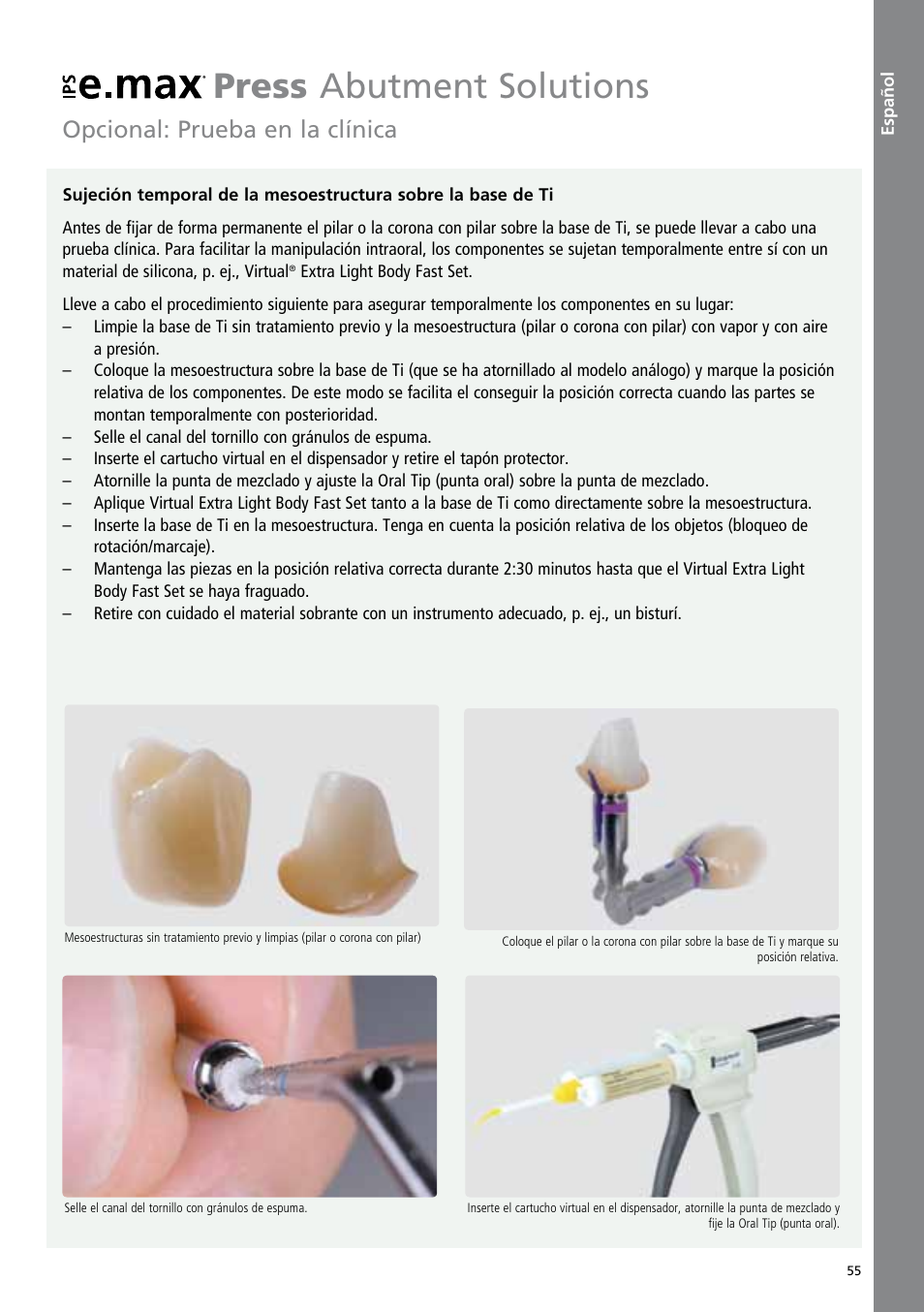 Español, Press abutment solutions, Opcional: prueba en la clínica | Ivoclar Vivadent IPS e.max Abutment Solutions Cem Kit v.3 User Manual | Page 55 / 80