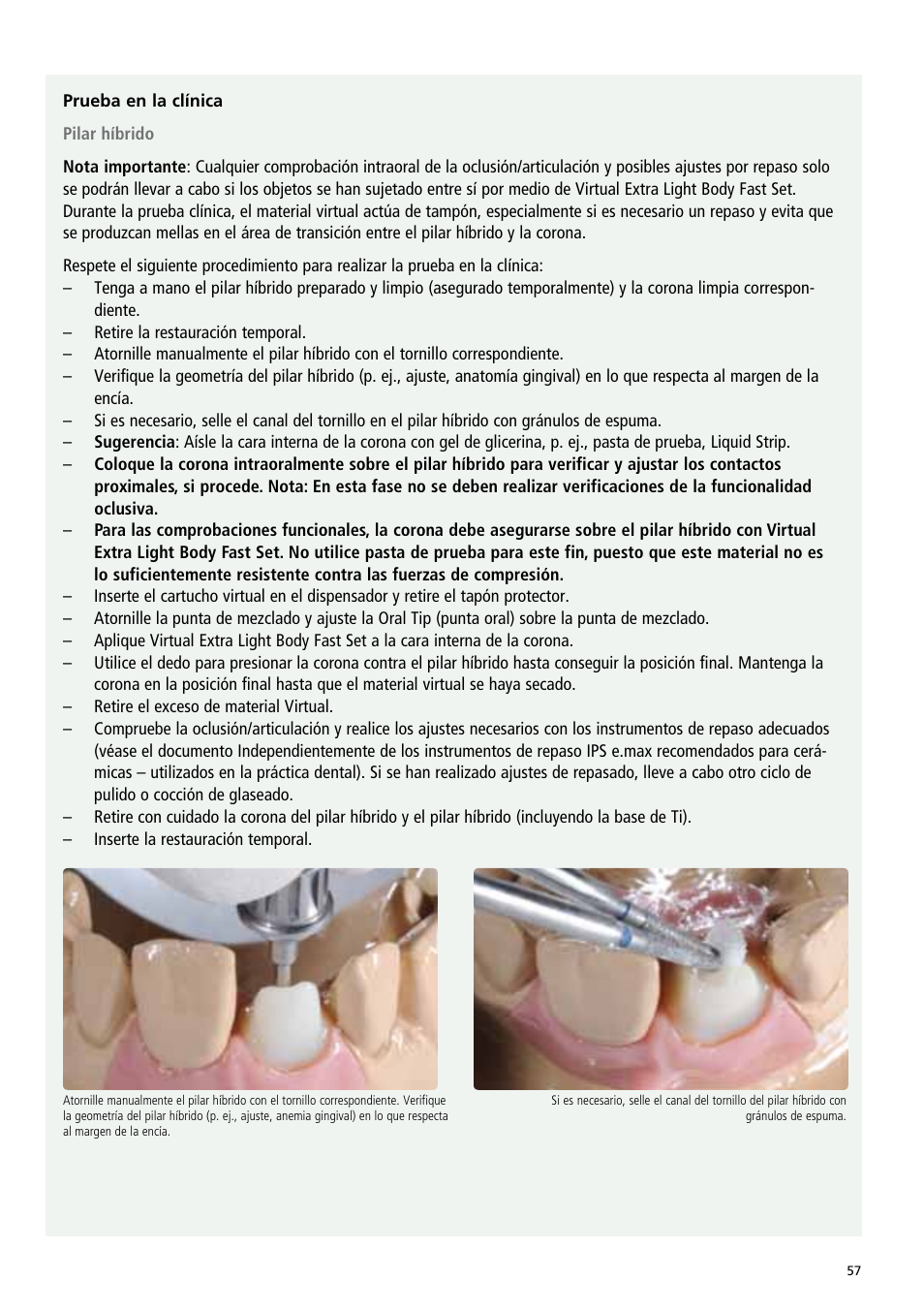 Ivoclar Vivadent IPS e.max Abutment Solutions Cem Kit v.3 User Manual | Page 57 / 80