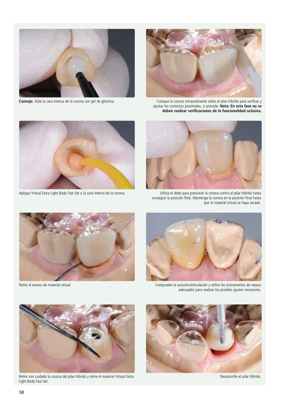 Ivoclar Vivadent IPS e.max Abutment Solutions Cem Kit v.3 User Manual | Page 58 / 80