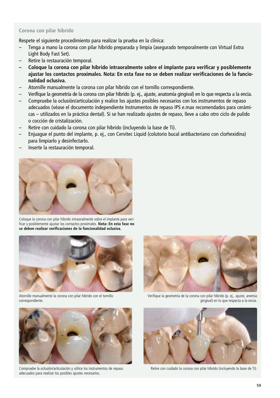 Ivoclar Vivadent IPS e.max Abutment Solutions Cem Kit v.3 User Manual | Page 59 / 80