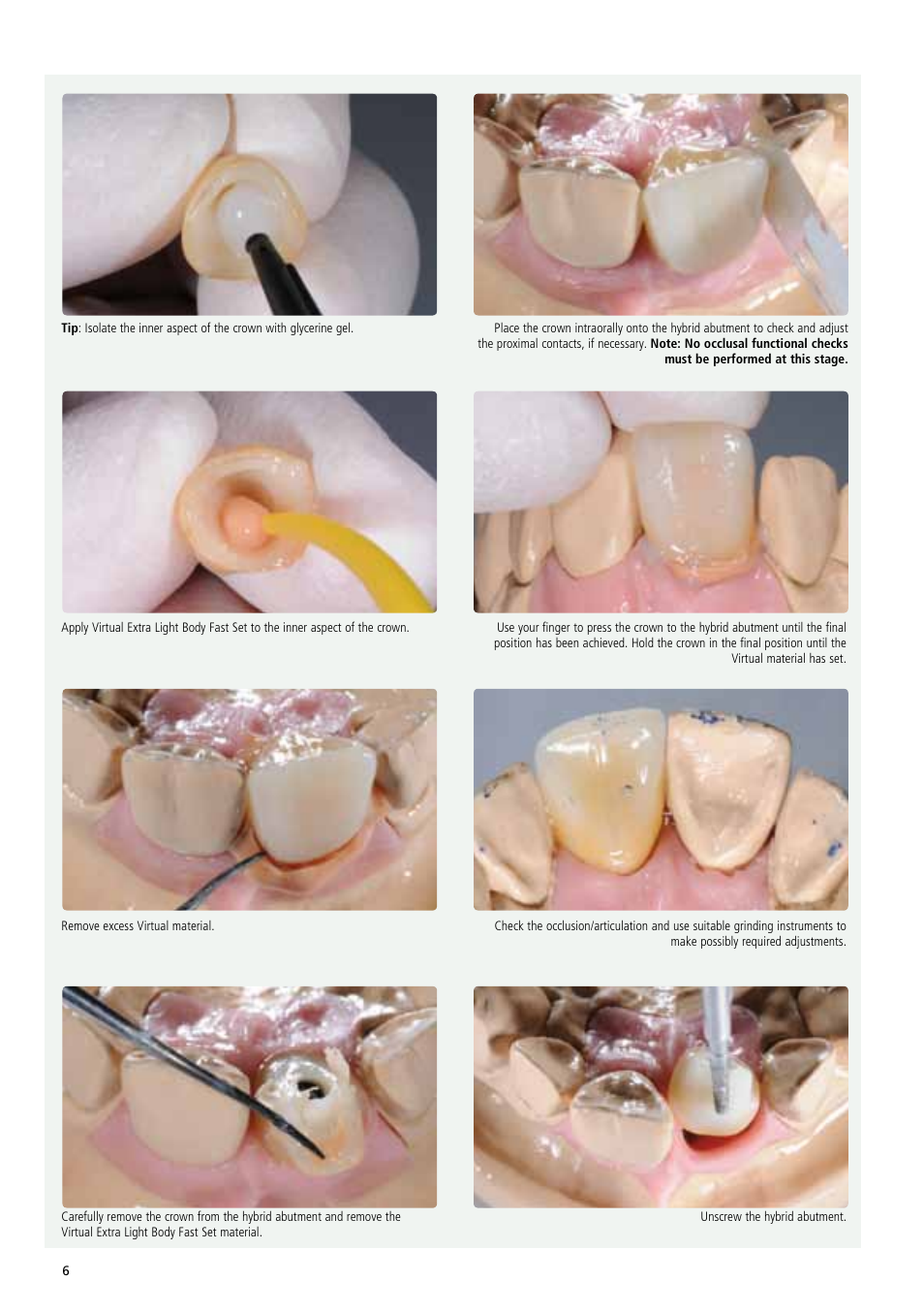 Ivoclar Vivadent IPS e.max Abutment Solutions Cem Kit v.3 User Manual | Page 6 / 80