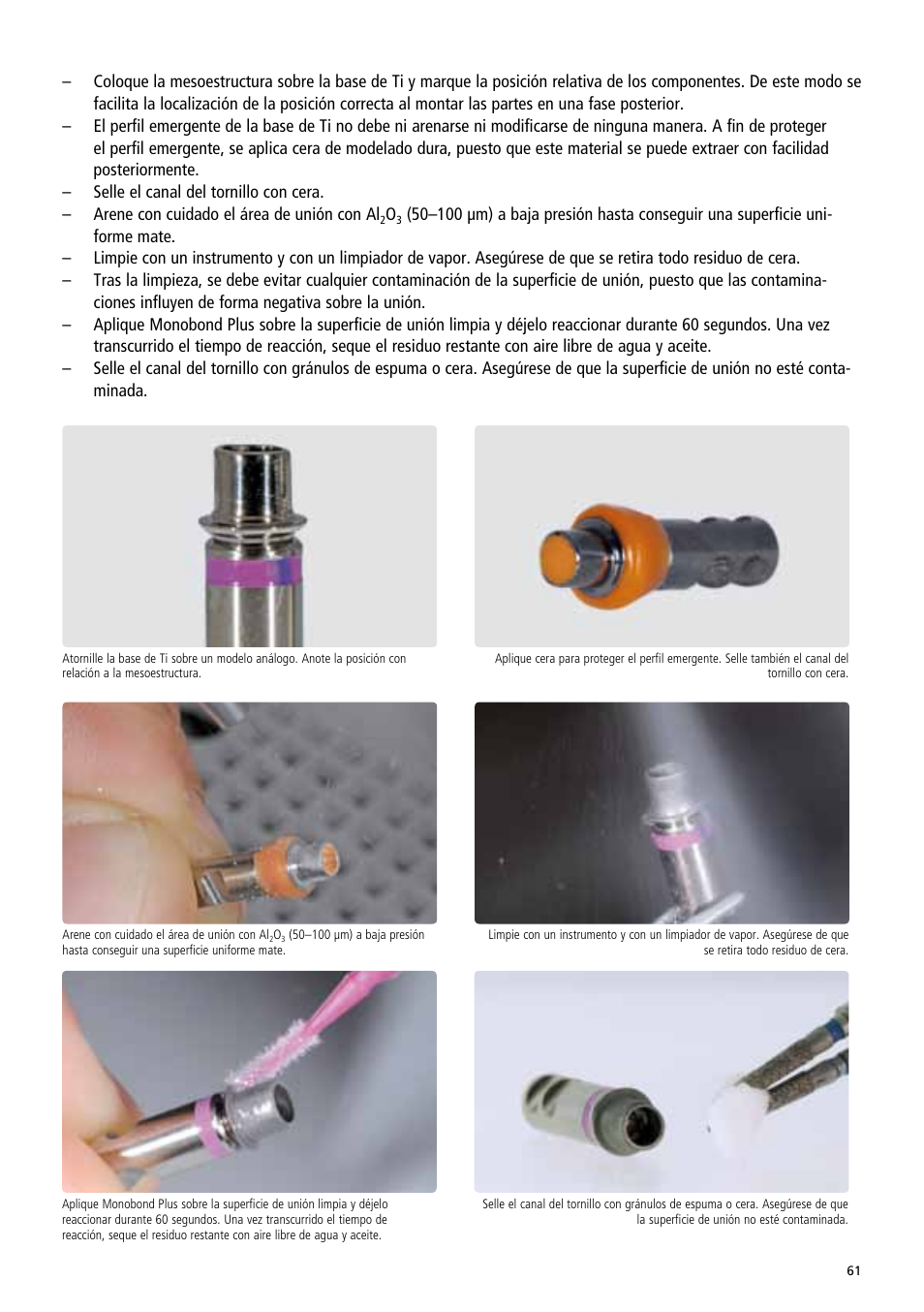 Ivoclar Vivadent IPS e.max Abutment Solutions Cem Kit v.3 User Manual | Page 61 / 80