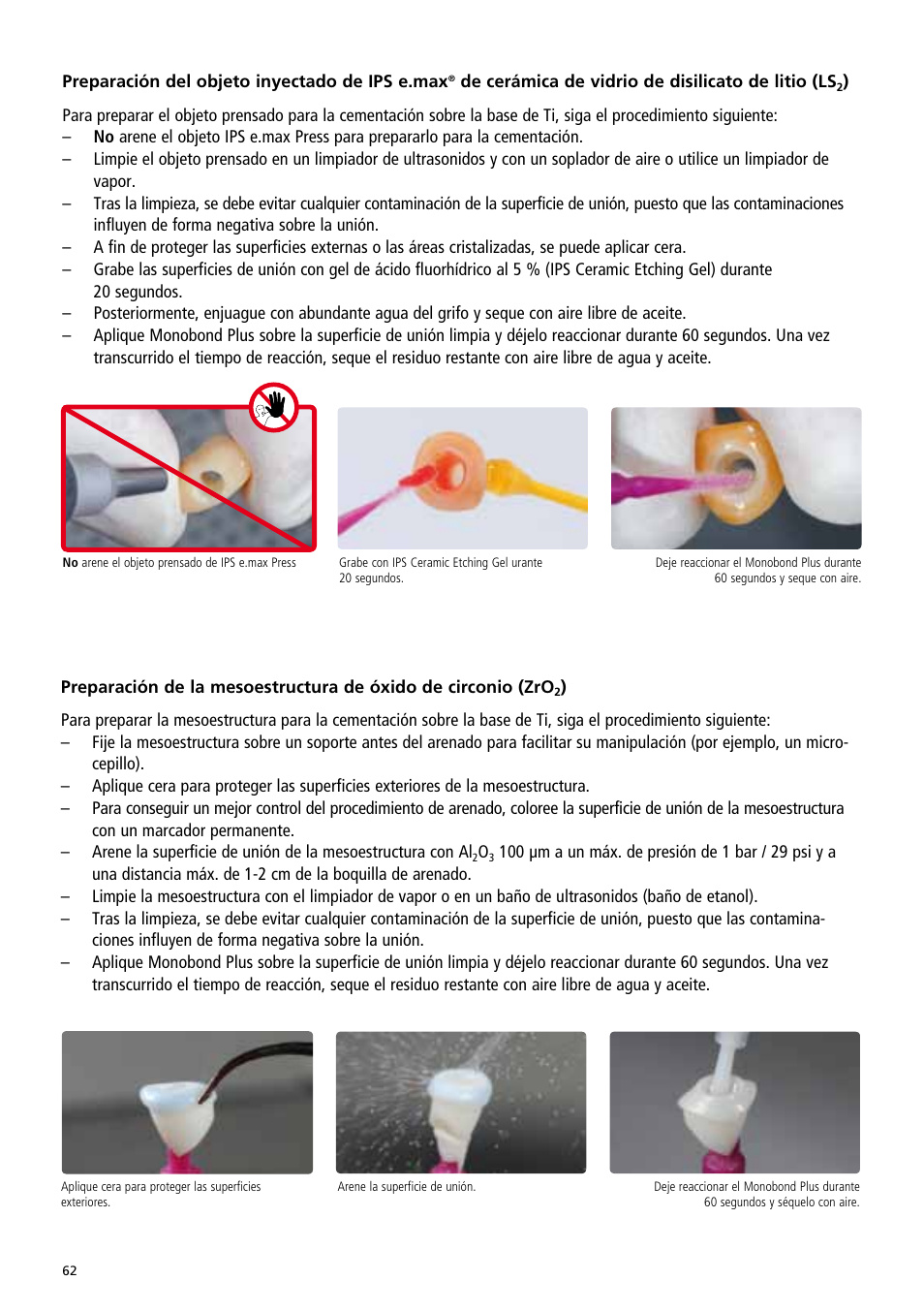 Ivoclar Vivadent IPS e.max Abutment Solutions Cem Kit v.3 User Manual | Page 62 / 80