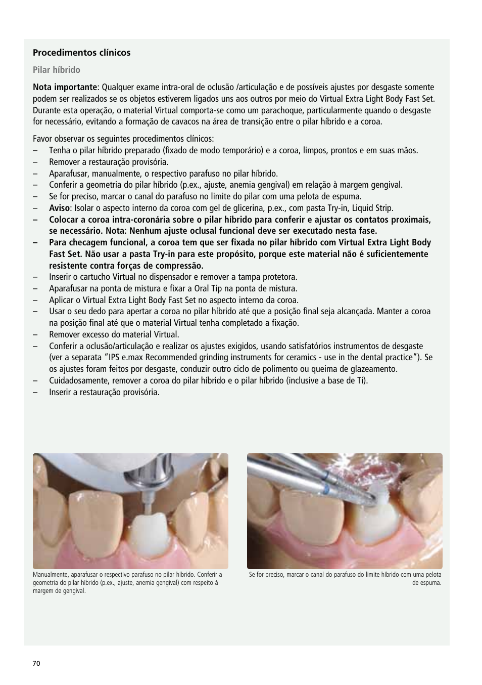 Ivoclar Vivadent IPS e.max Abutment Solutions Cem Kit v.3 User Manual | Page 70 / 80