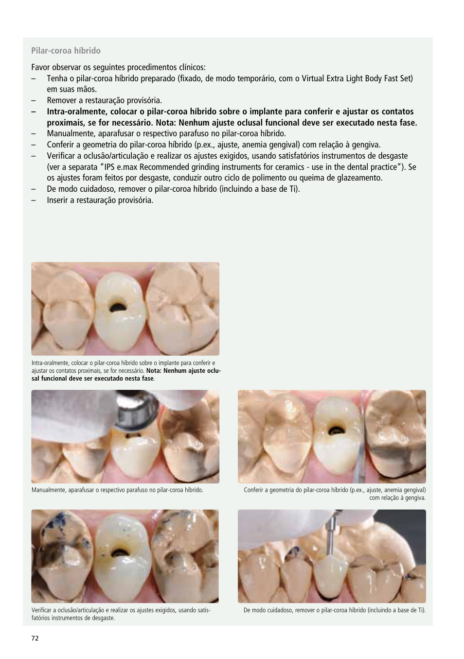 Ivoclar Vivadent IPS e.max Abutment Solutions Cem Kit v.3 User Manual | Page 72 / 80