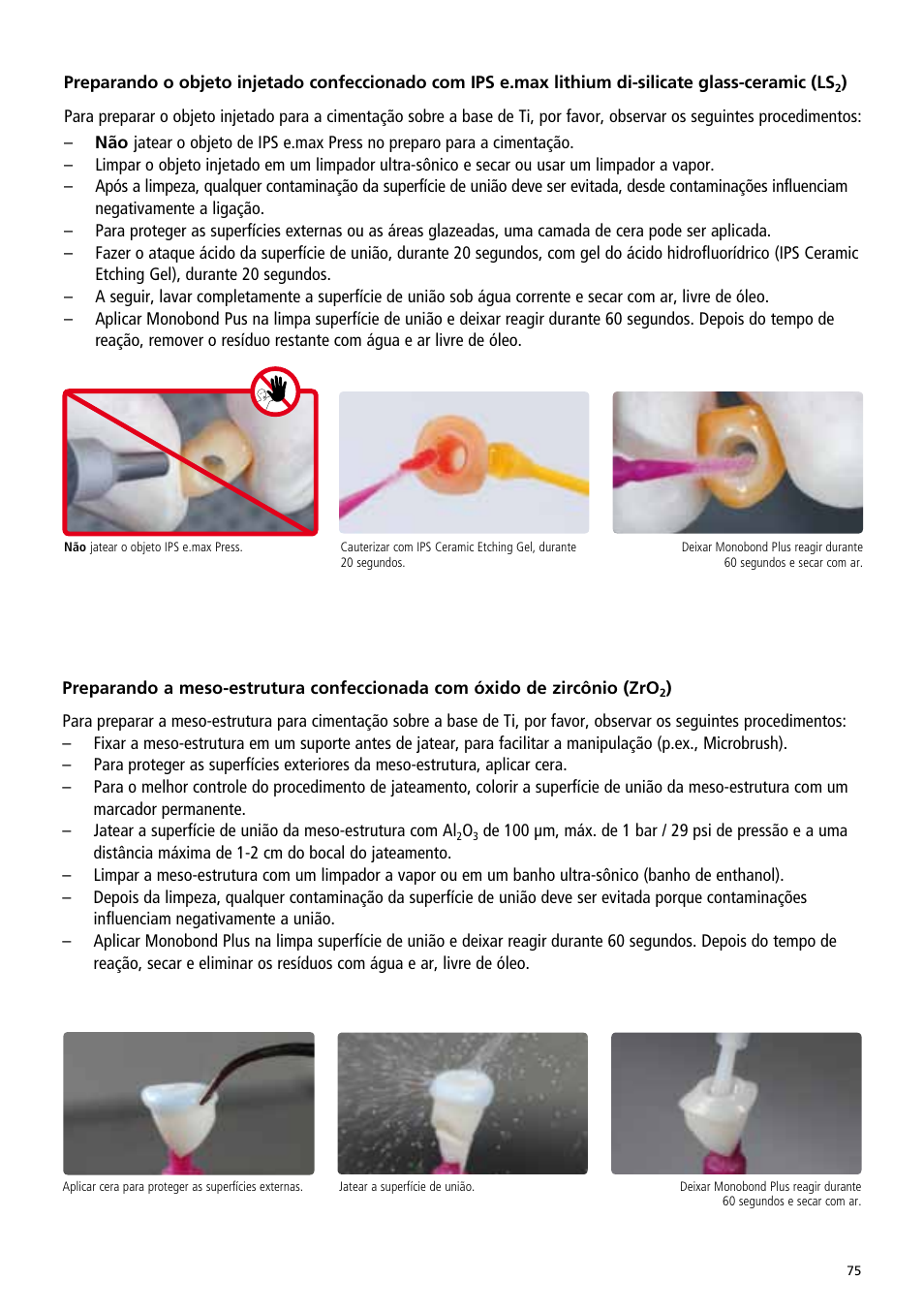 Ivoclar Vivadent IPS e.max Abutment Solutions Cem Kit v.3 User Manual | Page 75 / 80