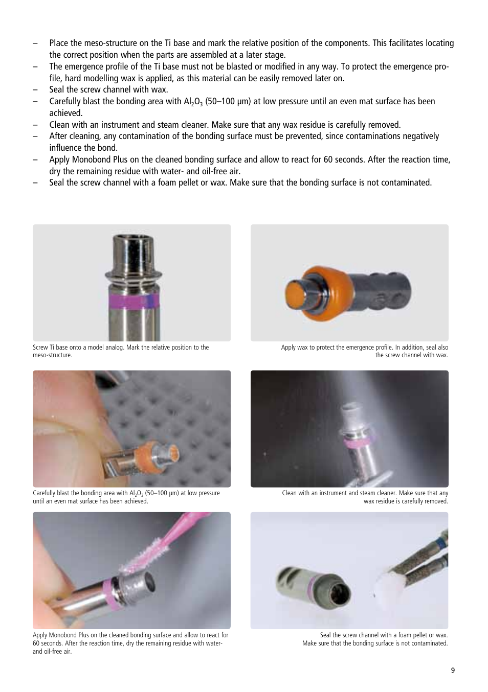 Ivoclar Vivadent IPS e.max Abutment Solutions Cem Kit v.3 User Manual | Page 9 / 80