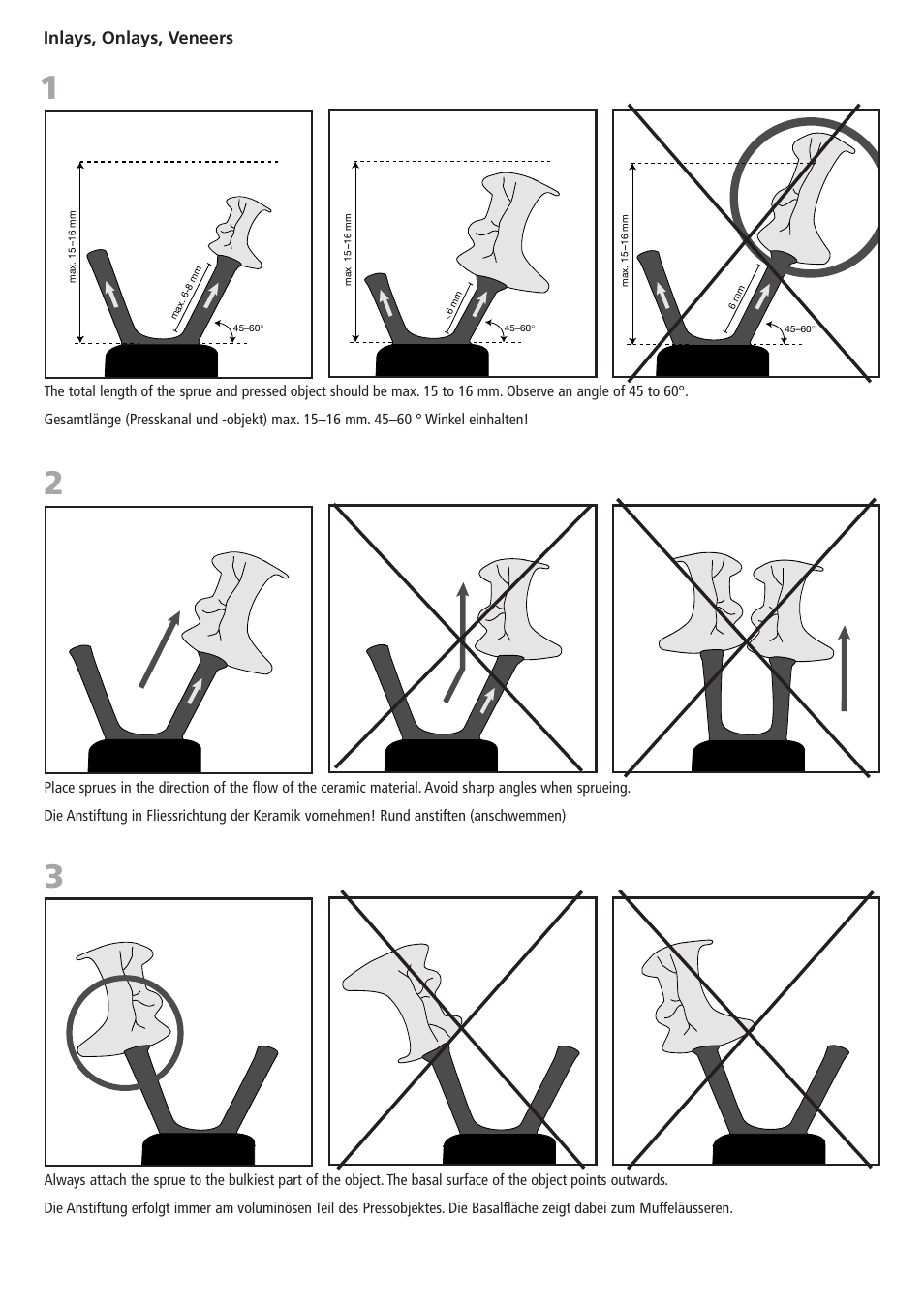 Inlays, onlays, veneers | Ivoclar Vivadent IPS PressVEST v1.pdf User Manual | Page 4 / 54