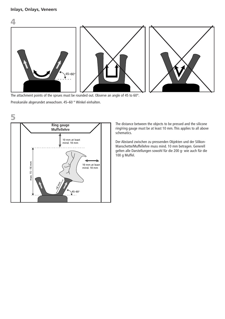 Inlays, onlays, veneers | Ivoclar Vivadent IPS PressVEST v1.pdf User Manual | Page 5 / 54