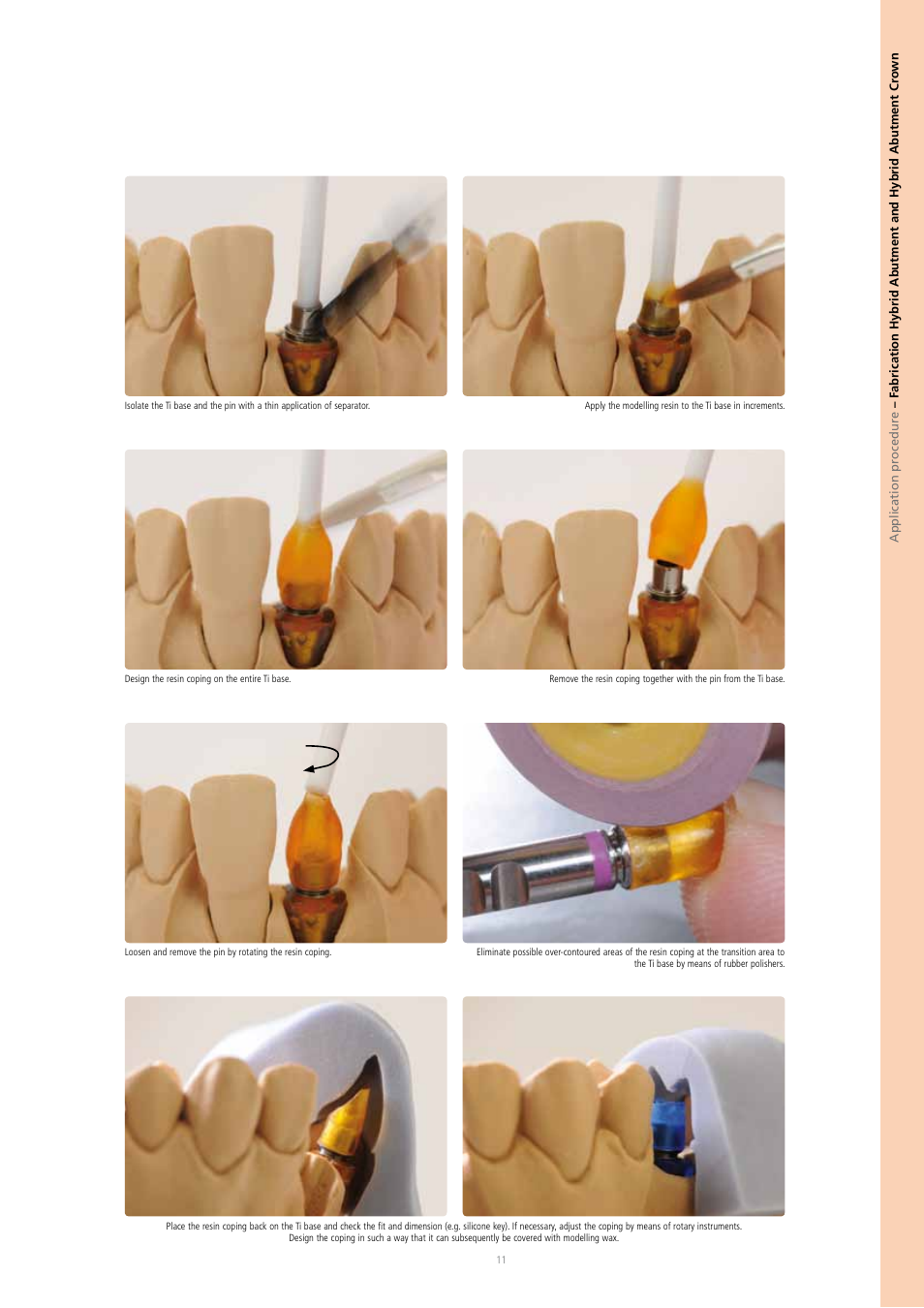 Ivoclar Vivadent IPS e.max Press Abutment Solutions v.2 User Manual | Page 11 / 56