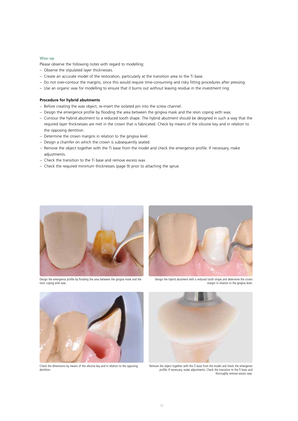 Ivoclar Vivadent IPS e.max Press Abutment Solutions v.2 User Manual | Page 12 / 56