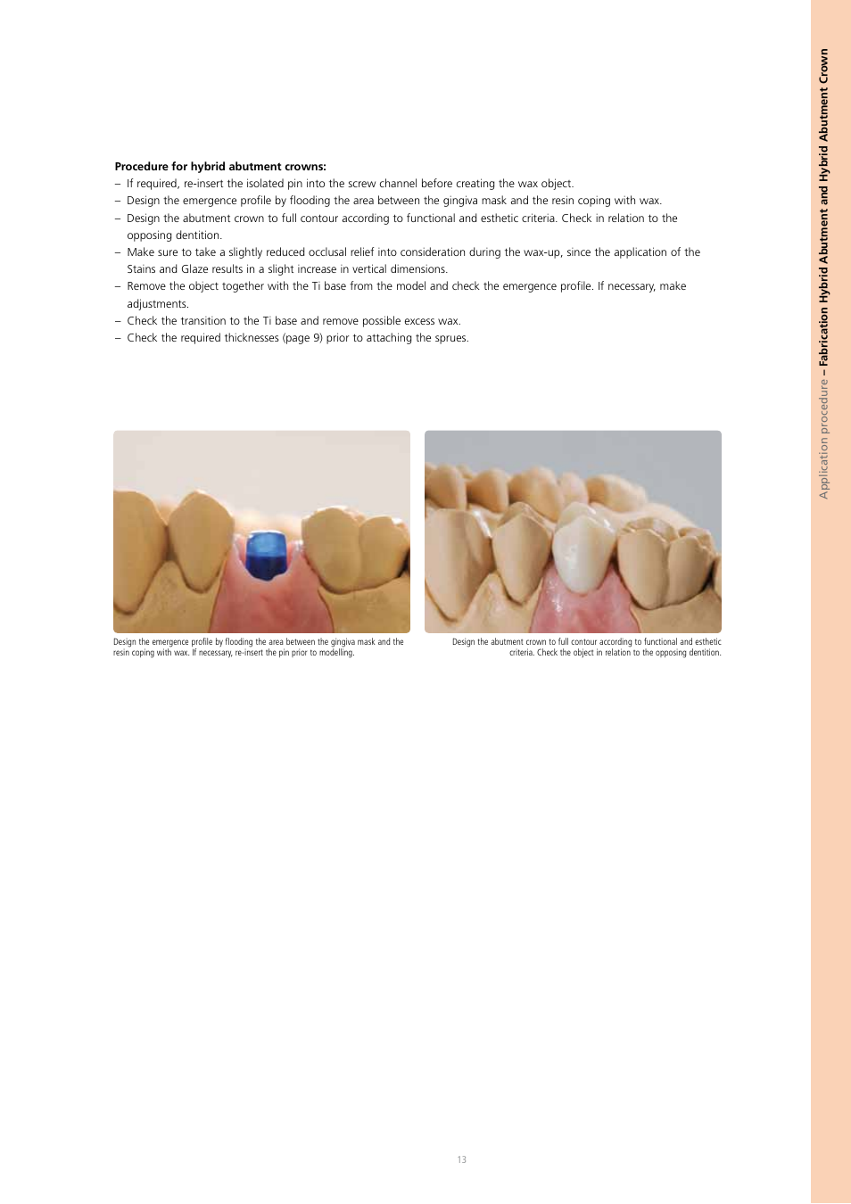 Ivoclar Vivadent IPS e.max Press Abutment Solutions v.2 User Manual | Page 13 / 56
