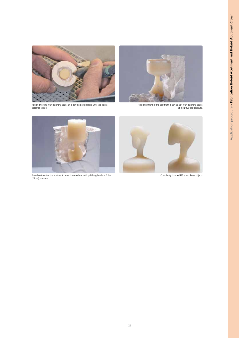 Ivoclar Vivadent IPS e.max Press Abutment Solutions v.2 User Manual | Page 21 / 56