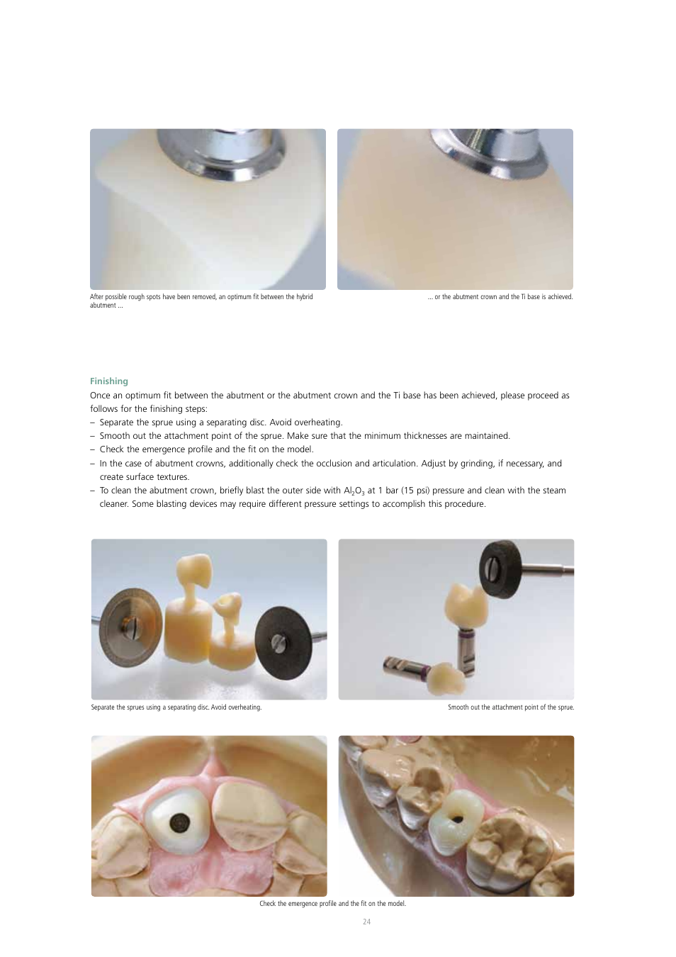 Ivoclar Vivadent IPS e.max Press Abutment Solutions v.2 User Manual | Page 24 / 56