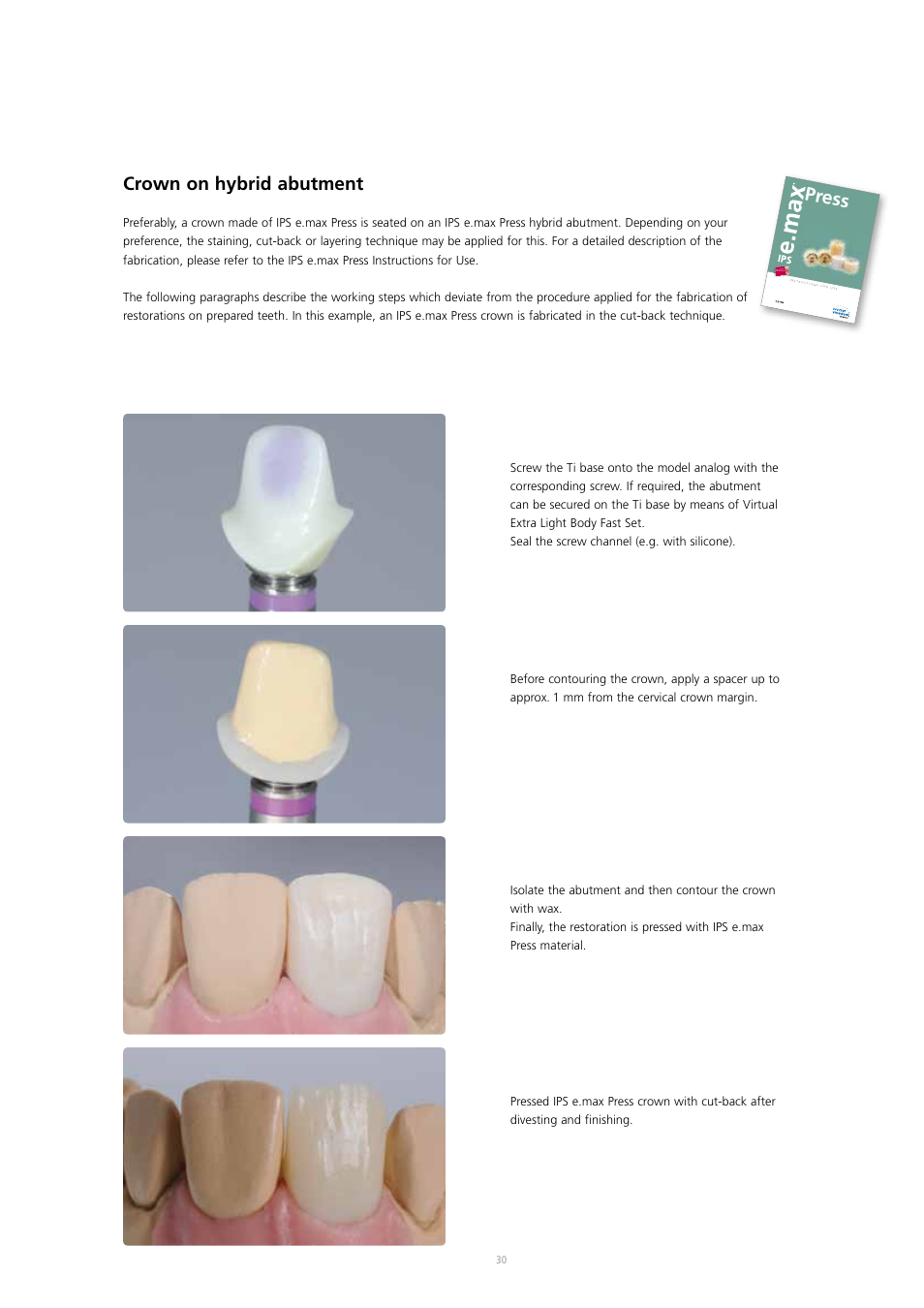 Crown on hybrid abutment, Press | Ivoclar Vivadent IPS e.max Press Abutment Solutions v.2 User Manual | Page 30 / 56