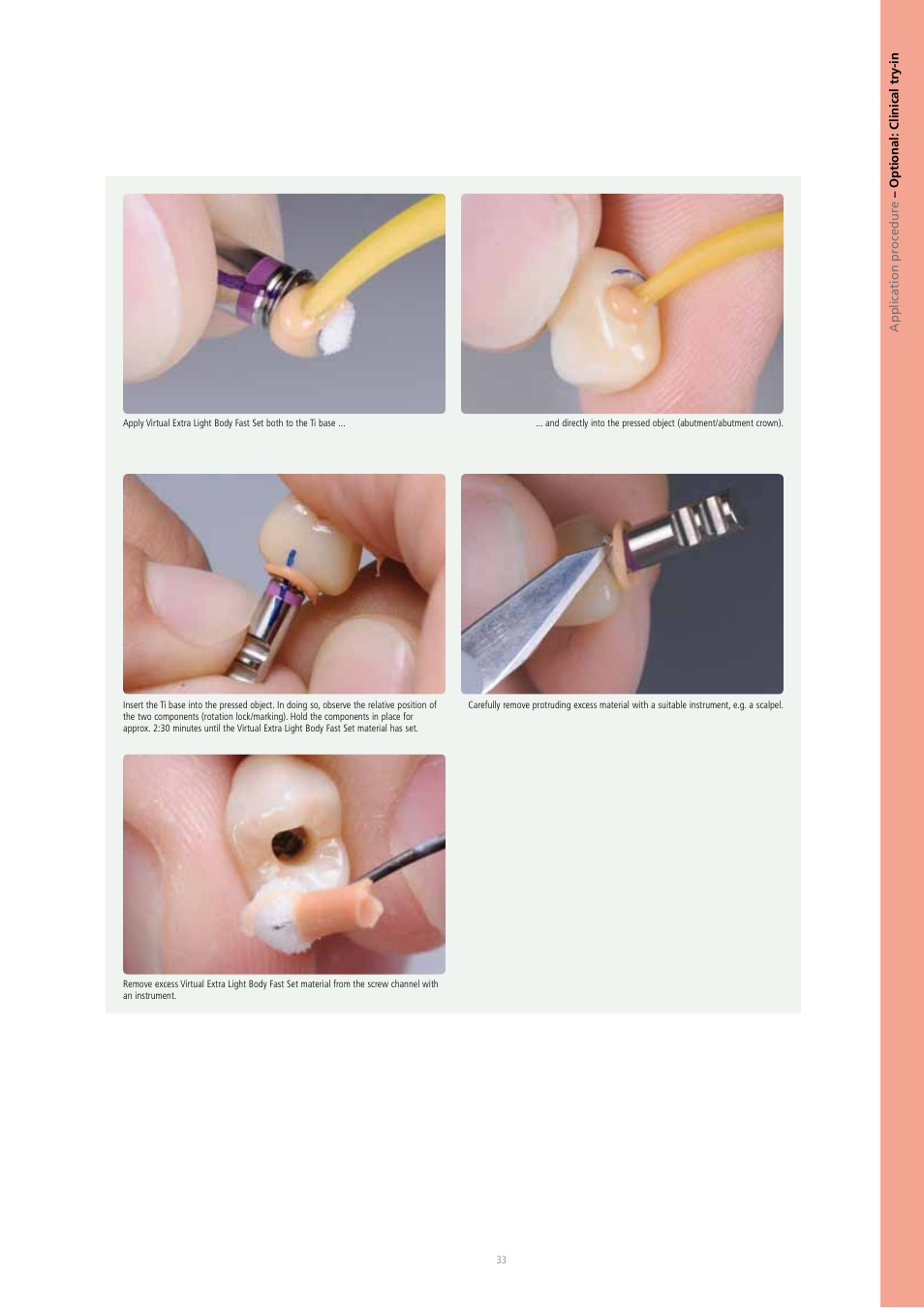 Ivoclar Vivadent IPS e.max Press Abutment Solutions v.2 User Manual | Page 33 / 56