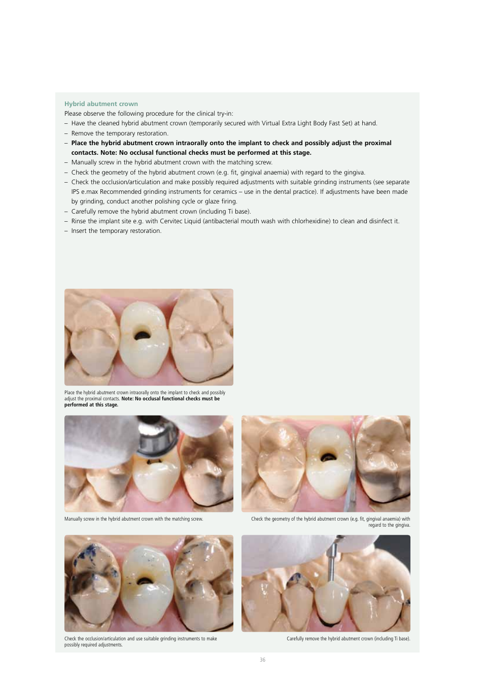 Ivoclar Vivadent IPS e.max Press Abutment Solutions v.2 User Manual | Page 36 / 56