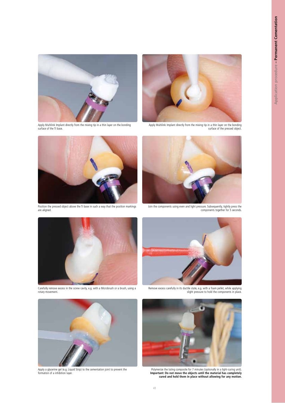 Ivoclar Vivadent IPS e.max Press Abutment Solutions v.2 User Manual | Page 41 / 56