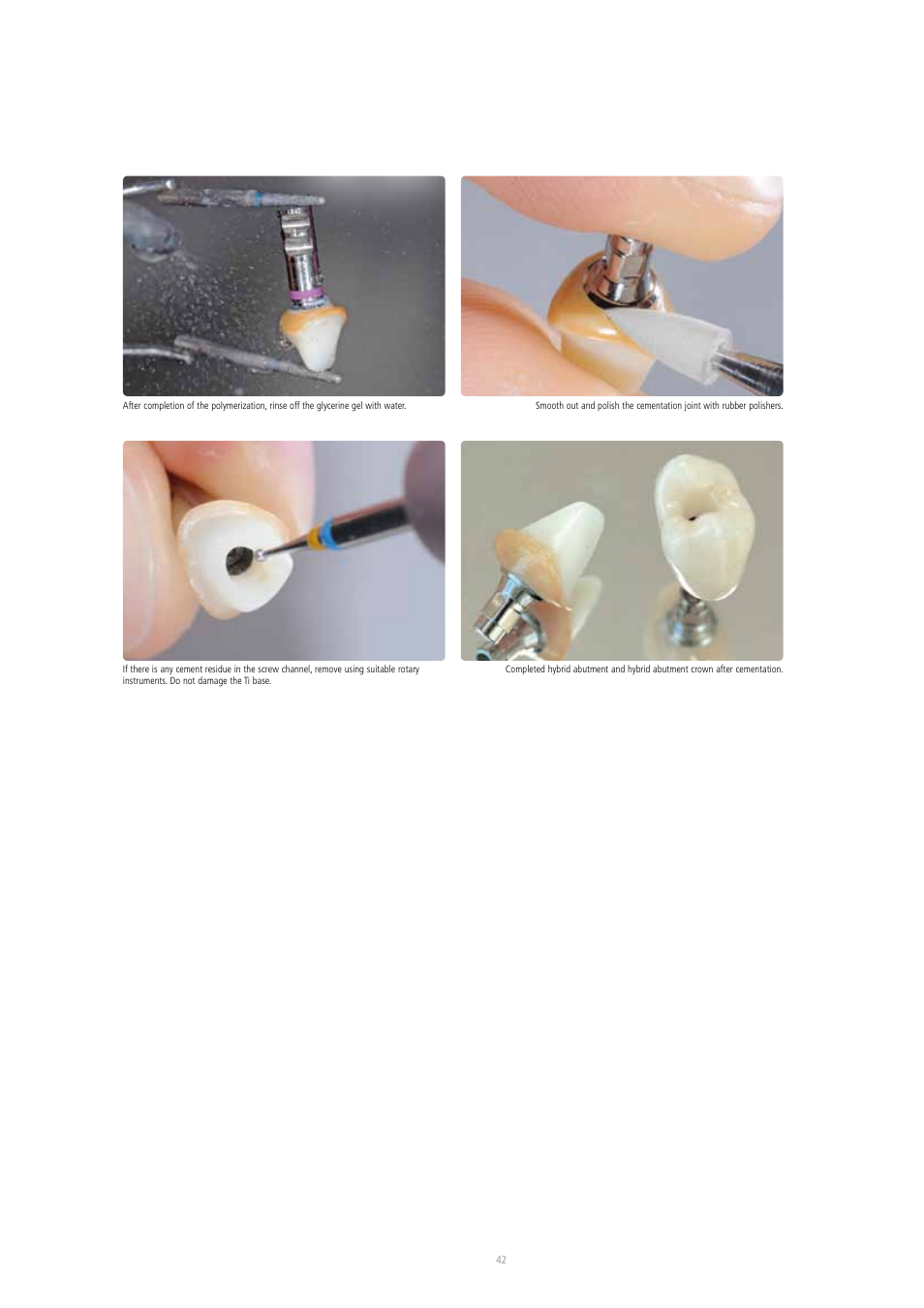 Ivoclar Vivadent IPS e.max Press Abutment Solutions v.2 User Manual | Page 42 / 56