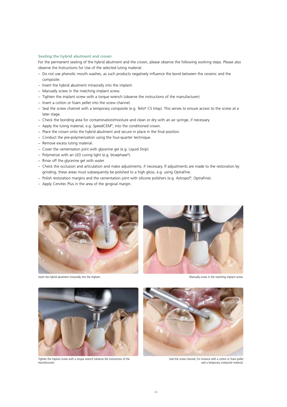 Ivoclar Vivadent IPS e.max Press Abutment Solutions v.2 User Manual | Page 44 / 56