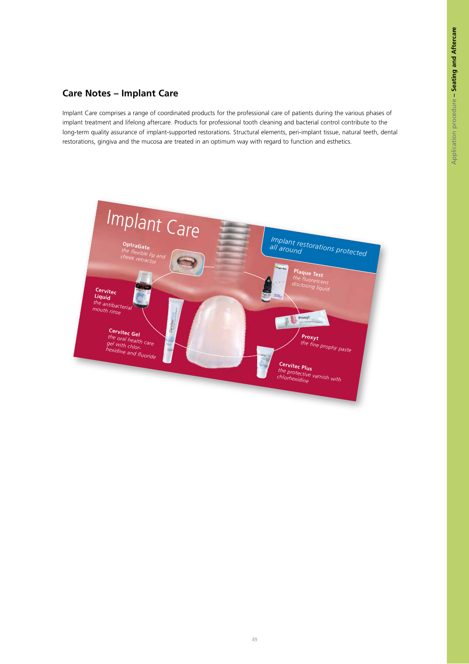 Implant care | Ivoclar Vivadent IPS e.max Press Abutment Solutions v.2 User Manual | Page 49 / 56