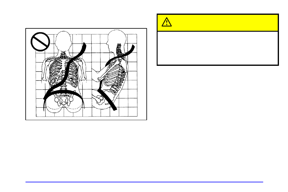 Caution | CHEVROLET 1999 Corvette User Manual | Page 27 / 376