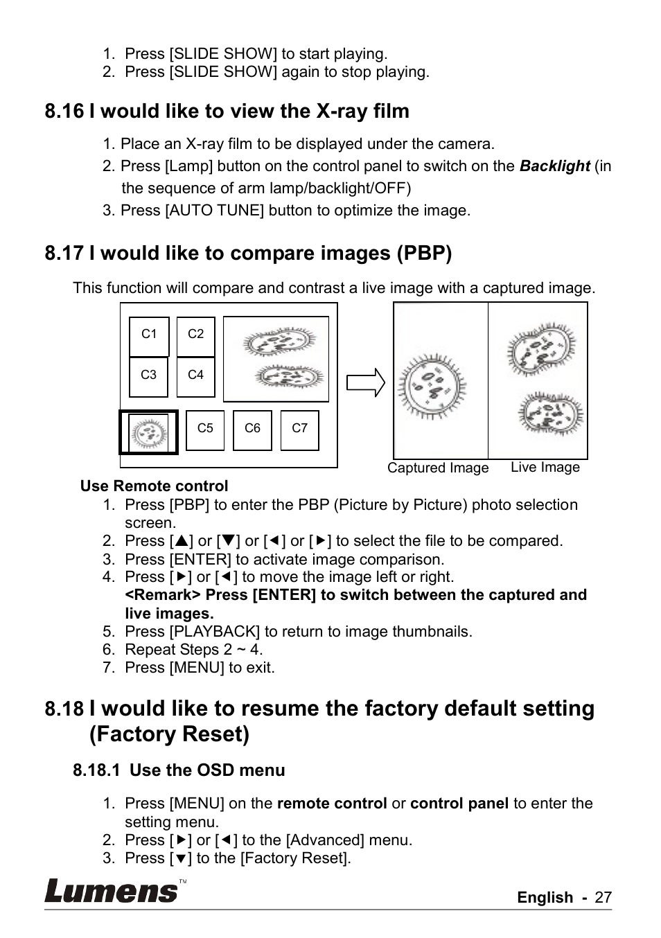 I would like to view the x-ray film, I would like to compare images (pbp), 16 i would like to view the x-ray film | 17 i would like to compare images (pbp) | Lumens Technology PS750 User Manual | Page 28 / 44