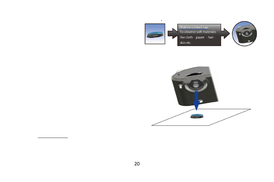 Application of supporters, Shallow contact cap, Instruction | MicroLinks PRO10 - user guide User Manual | Page 22 / 25