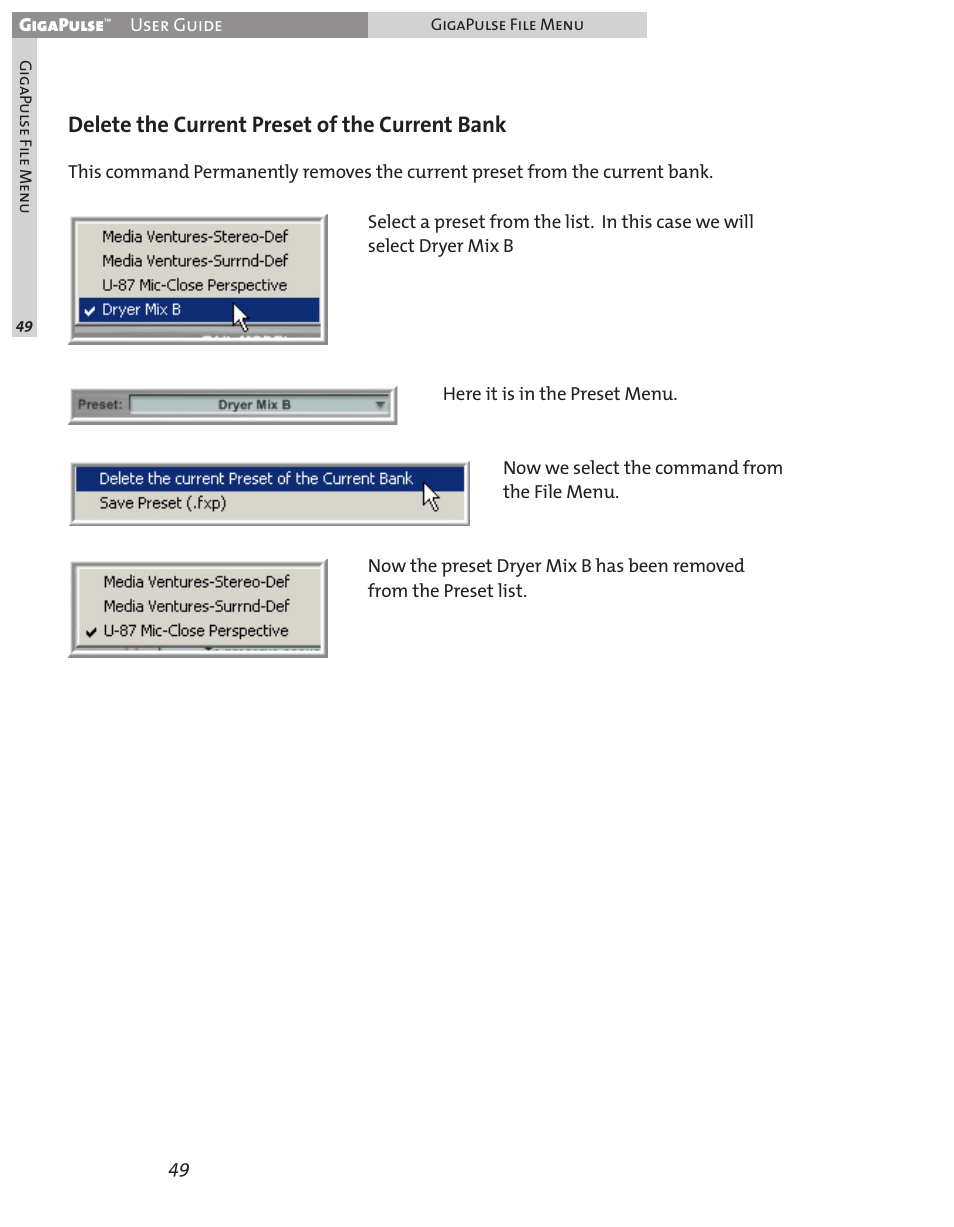 Delete the current preset of the current bank | Teac GigaPulse User Manual | Page 49 / 191